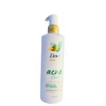 Dove acne cleanser